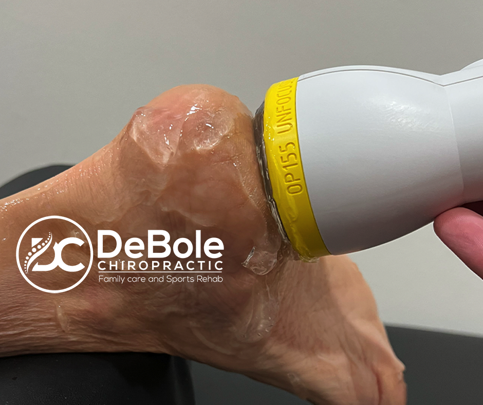 Plantar Fasciitis Relief with SoftWave Therapy at DeBole Chiropractic